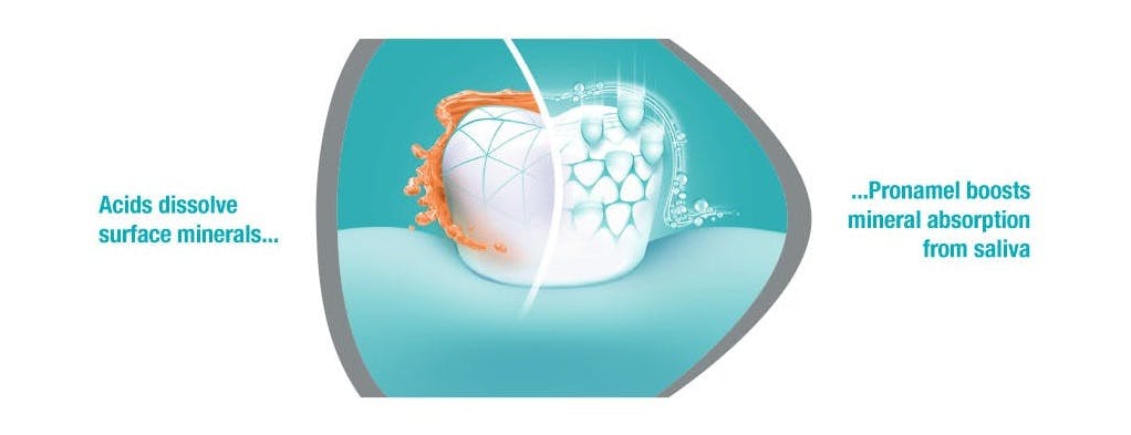 Pronamel Mineral Boost: Gentle Whitening Action | Pronamel