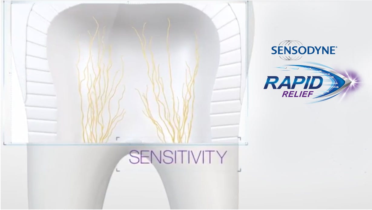 $imgtitle sensodyne rapid relief works