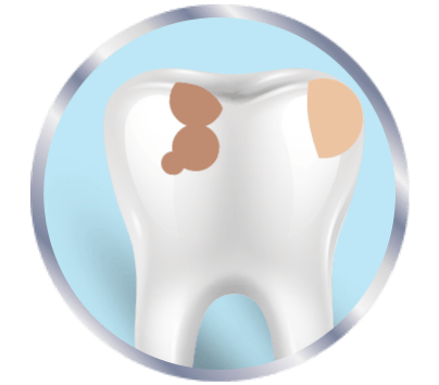Is It A Cavity Or Sensitive Teeth Sensodyne