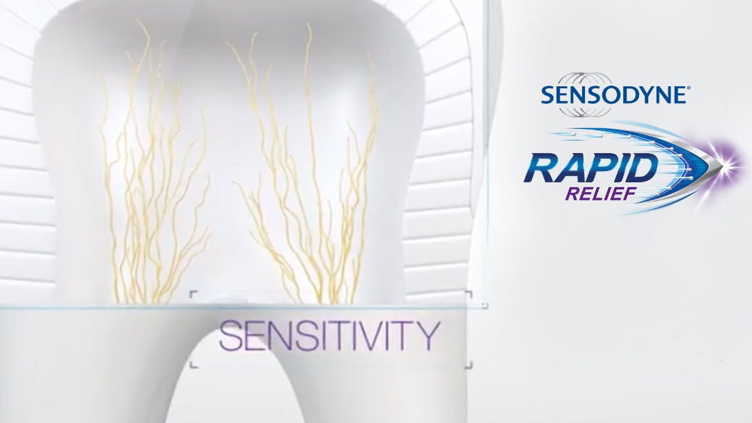 $imgtitle Video showing how Sensodyne Rapid Relief targets tooth sensitivity