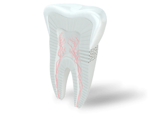 Wird schmerzt und zahn grau Zahngranulome