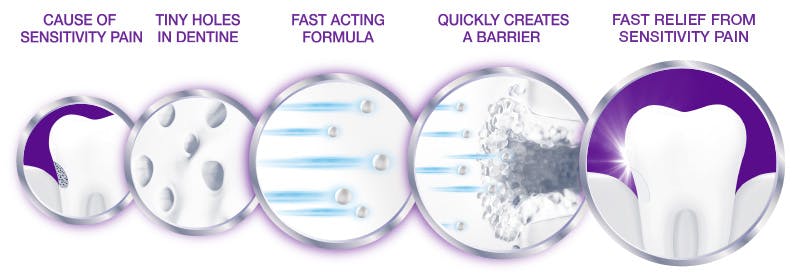 How Sensodyne Rapid Works in Stages How Sensodyne Rapid Works in Stages