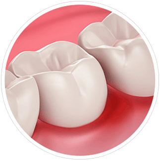 Gum Health and Sensitivity Gum Health and Sensitivity