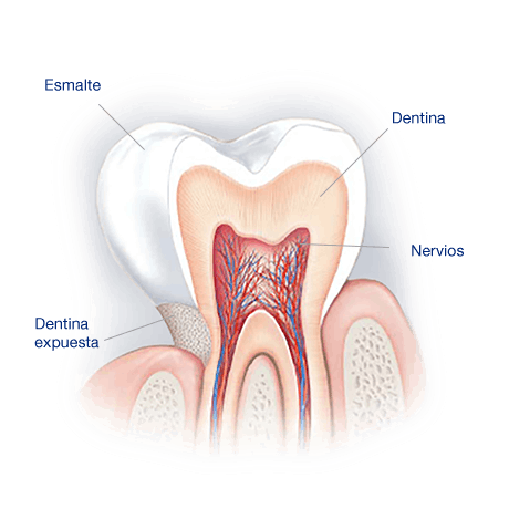 What Causes Sensitive Teeth? What Causes Sensitive Teeth?