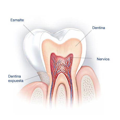 What Causes Sensitive Teeth? What Causes Sensitive Teeth?