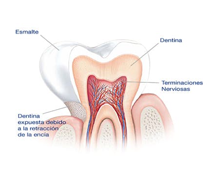 ¿Qué causa la sensibilidad dental? ¿Qué causa la sensibilidad dental?
