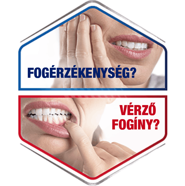 Fogérzékenység & vérző fogíny Fogérzékenység & vérző fogíny
