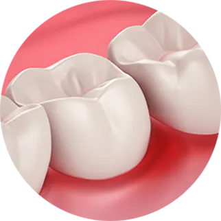 בריאות החניכיים ורגישות