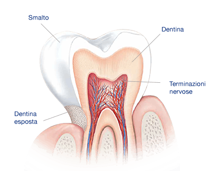 Ipersensibilità dentinale. Che cosa causa i denti sensibili? Ipersensibilità dentinale. Che cosa causa i denti sensibili?