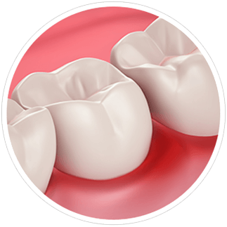 Salud de las encías y sensibilidad dental Salud de las encías y sensibilidad dental