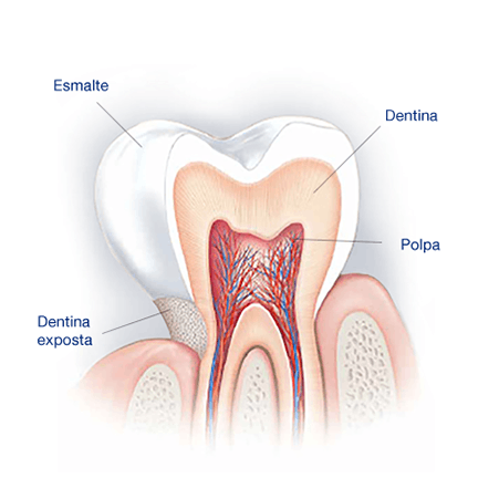 Quais são as causas dos dentes sensíveis? Quais são as causas dos dentes sensíveis?