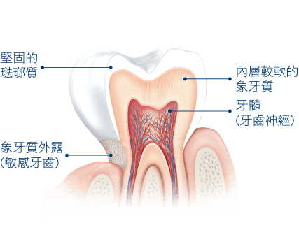 引起敏感牙齒的原因是什麼? 引起敏感牙齒的原因是什麼?