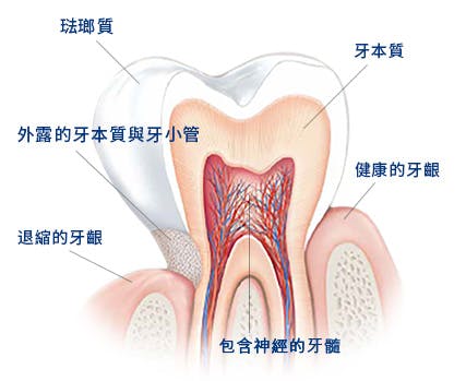 造成敏感性牙齒的原因為何? 造成敏感性牙齒的原因為何?