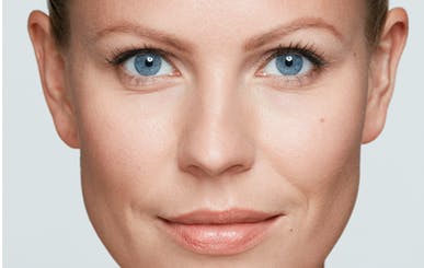 SPOTS WHERE A COLD SORE IS LIKELY TO POP UP SPOTS WHERE A COLD SORE IS LIKELY TO POP UP