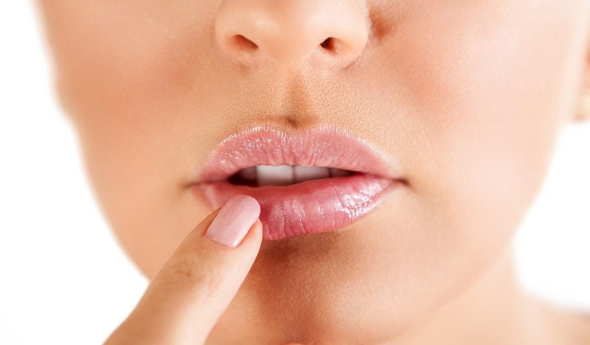How to Stop Spreading Cold Sores