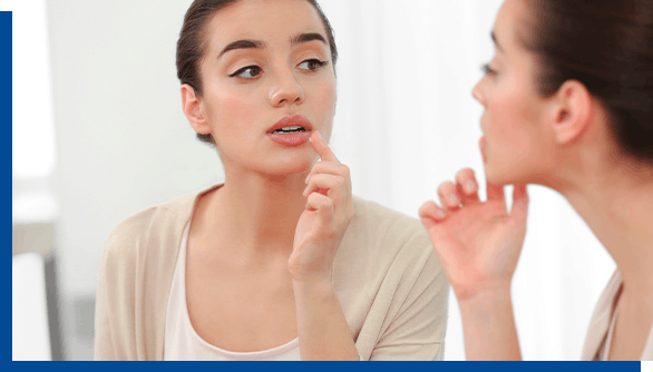 Young woman looking in mirror while applying Abreva Cold Sore Cream Young woman looking in mirror while applying Abreva Cold Sore Cream