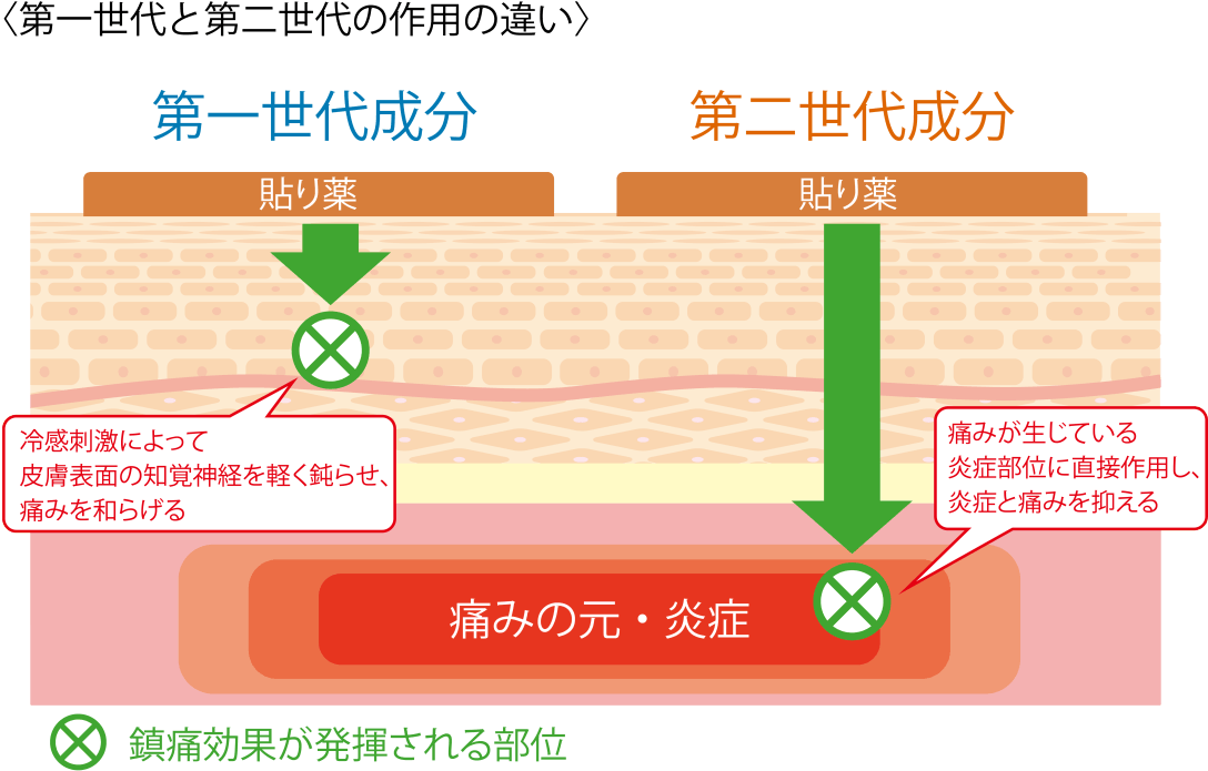 私のつらい痛みに合う外用消炎鎮痛剤の成分は何ですか 私のつらい痛みに合う外用消炎鎮痛剤の成分は何ですか